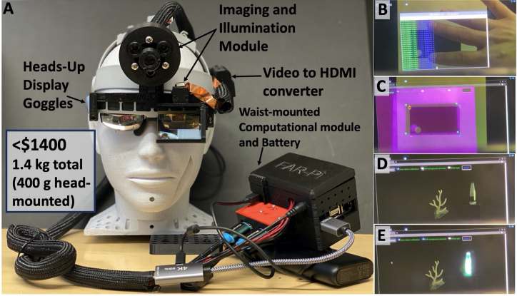 Photo for Low-cost augmented reality goggles enable precision fluorescence-guided cancer surgery
